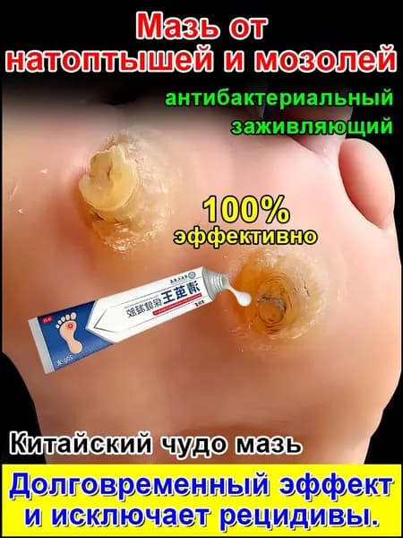 Mазь от мозолей стержневых и натоптышей ,Крем от сухих мозолей, шипицы, бородавок, натоптышей,20 г.