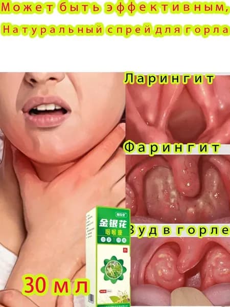 Китайский чудо-спрей для горла от простуды и ангины, фарингита, 30 мл, травяная формула