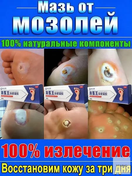 Крем для удаления натоптышей, бородавок, шипов и заноз на пятках, колломаковых бородавок и папиллом, средство от натоптышей на ногах