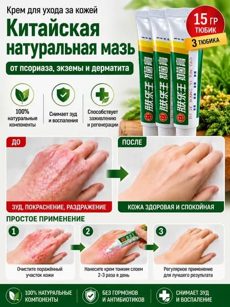 Натуральная китайская мазь от псориаза, экземы и дерматита, быстрое снятие зуда и воспаления, 3 шт