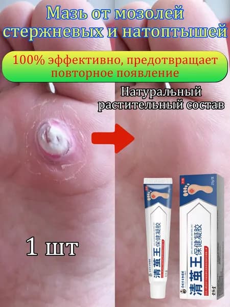 Mазь от мозолей стержневых и натоптышей ,Крем сухих мозолей, шипицы, бородавок, натоптышей,20 г 1 шт