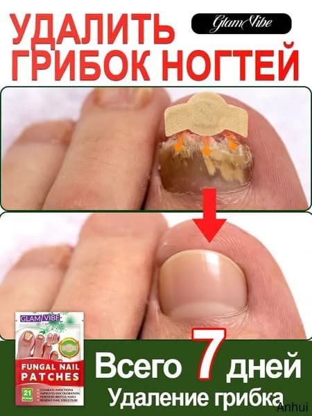 улучшают состояние утолщенных и пожелтевших ногтей