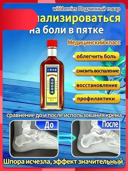 медицинская желчь для пяточной шпоры жидкая 51 г