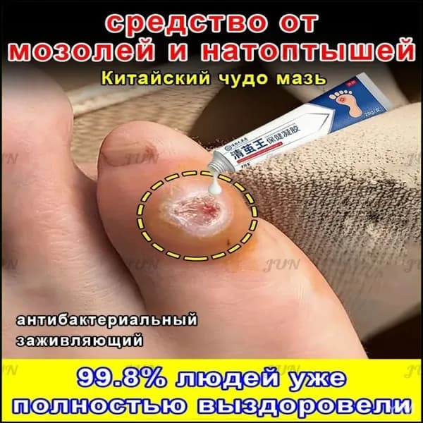 Средство для удаления натоптышей