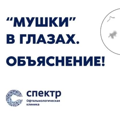 Мушки в глазах . ОБЪЯСНЕНИЕ! Реально ли избавиться? | Кожухов Арсений Александрович | Электронная аудиокнига