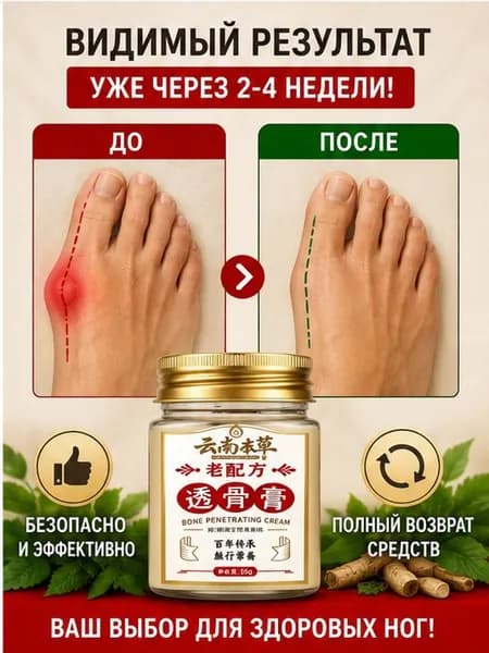 Легендарный тайский крем от косточки на ноге