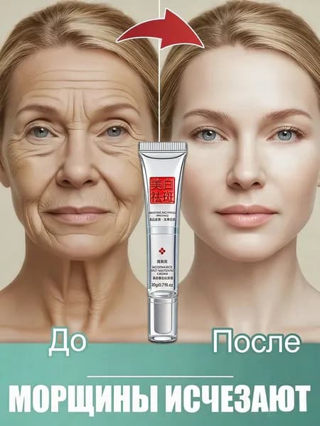 ARAVIA Крем для антивозрастной, ретидерм крем для лица антивозрастной. с гиалуроновой кислотой, витамин с и мочевиной, устраняет темные круги, от отеков и мешков под глазами, Средство против морщин