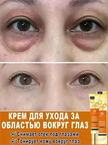 DODOYURI крем для век антивозрастной для кожи вокруг от темных кругов и морщин 20 мл