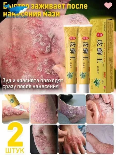 Мазь от псориаза экземы и грибка ногтей на ногах