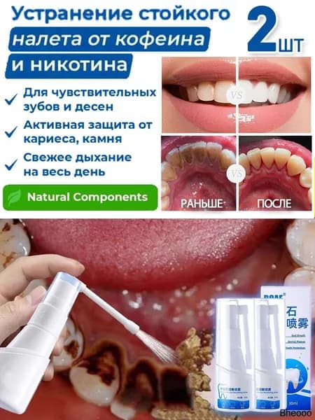 Зубной спрей для растворения зубного камня,2 шт.