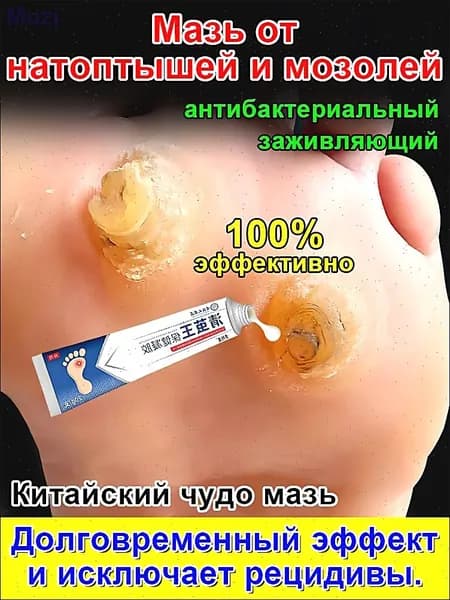 Mазь от мозолей стержневых и натоптышей ,Крем от сухих мозолей, шипицы, бородавок, натоптышей,20 г.