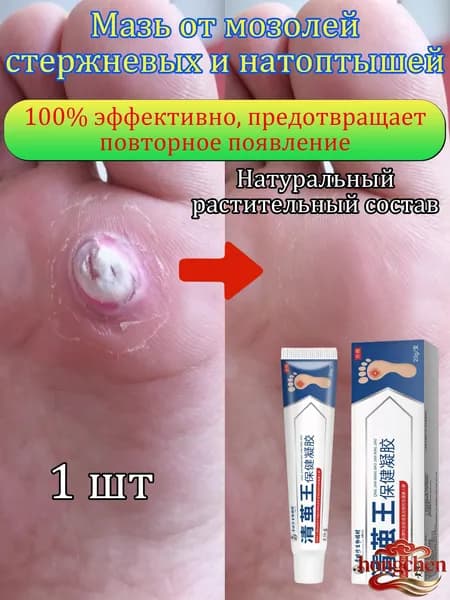Mазь от мозолей стержневых и натоптышей ,Крем от сухих мозолей, шипицы, бородавок, натоптышей,20 г 1 шт.