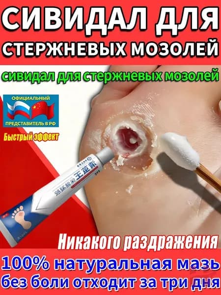 Средство от шипиц, натоптышей и сухих стержневых мозолей на ногах мазь и гель Корнекс,эффективное китайское средство