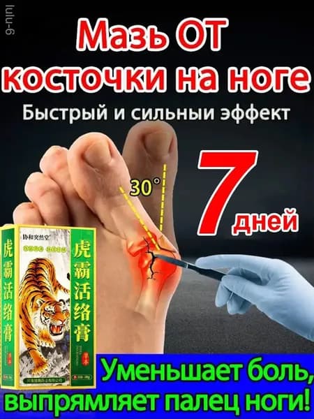 Мазь от вальгусной деформации стопы/20 мл, специальная для лечения воспаленных костей стопы