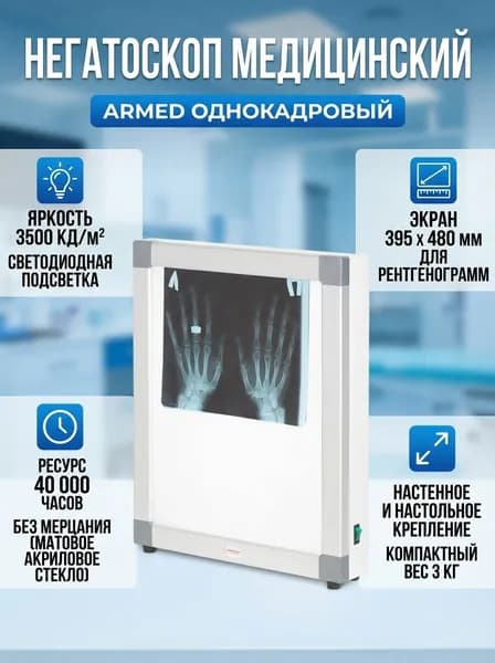 Негатоскоп медицинский Armed однокадровый, для рентген кабинета, 490x580 мм, акриловое стекло, крепление на стену, 3500 кд/м2 50 Вт