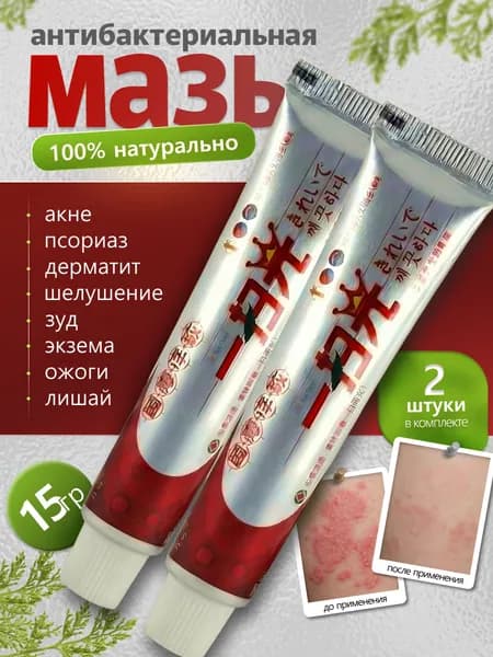 Китайская чудо мазь от прыщей, псориаза, экземы, дерматита, лишая, акне, Крем от псориаза китайский 2шт