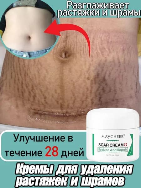 Средство от растяжек,новинка 2025