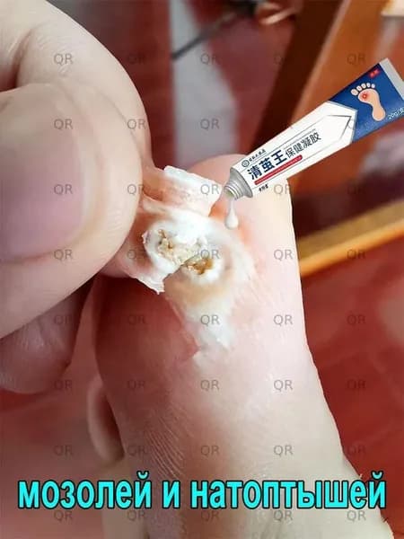 Средство для удаления натоптышей