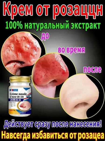 Мазь, используемая для лечения розацеа, телеангиэктазии и покраснений на лице.