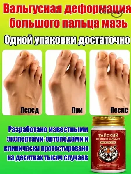 Крем при вальгусной деформации, от шишек на больших пальцах ног,50 мл