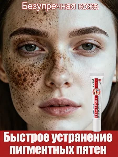 Крем от пигментации для лица, удаляет пигментные пятна, против пигментации, осветляет, для мужчин и женщин, 20 г,