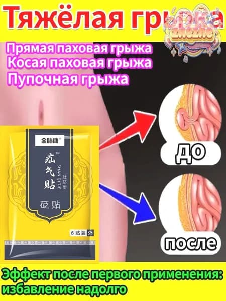 Пластырь от симптомов паховой грыжи: боль и тяжесть внизу живота
