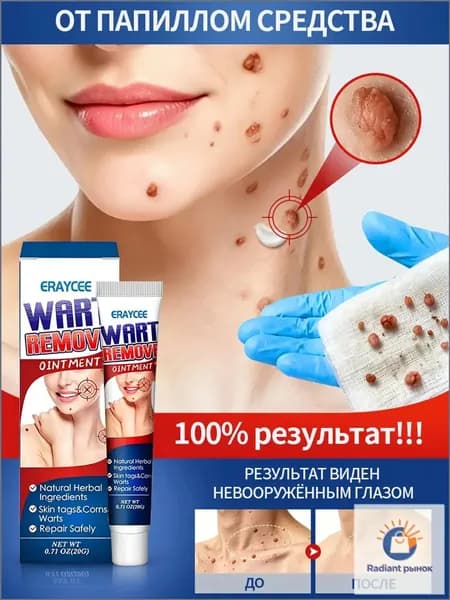 от бородавок 7 дня удаление папиллом, родинок и подошвенных бородавок. Безболезненно, без остатка, без побочных эффектов безопасное и эффективное восстановление кожи.