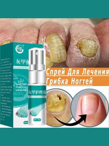 спрей-сыворотка для лечения грибка ногтей,10мл