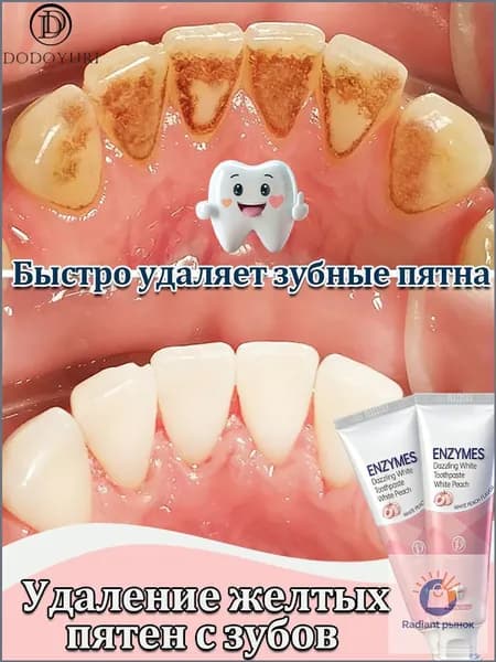 DODOYURI Профессиональная отбеливающая зубная паста с фтором и кальцием.Энзимная формула для борьбы с зубным камнем и темным налетом.Масса: 100 г.