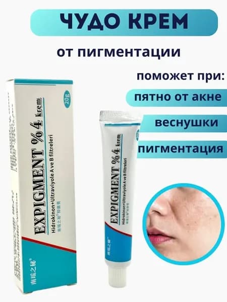 Чудо крем от пигментации- веснушек и следов постакне