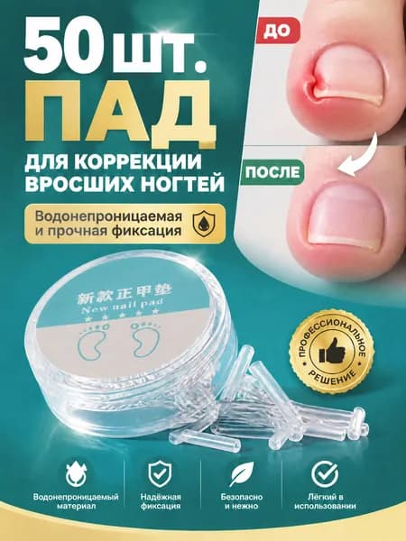 Коректор от вросших ногтей на ногах 50 шт - эффективное исправление и лечение вросших ногтей