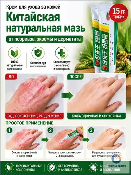 Быстрое снятие зуда и воспаления Натуральная китайская мазь от псориаза, экземы и дерматита