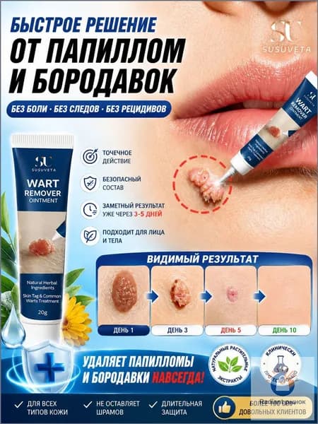 Средство от папиллом крем для удаления бородавок и папиллом, мягко растворяет наросты, безопасно для ко