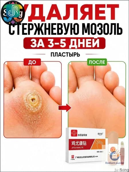 Ju-Rong-S-ing-Качественный пластырь для удаления бородавок, стержневых мозолей и натоптышей, 12 штук