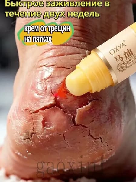 Крем для ухода за кожей 15 Крем для ухода за кожей