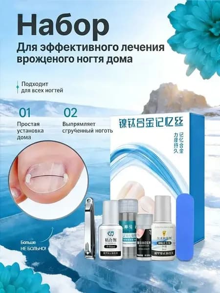 Комплект качественных корректоров для вросших ногтей из 30 никелидтитановых пластин