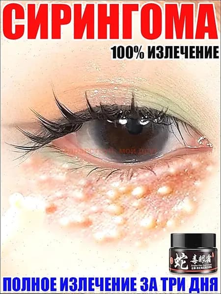 средство от милиумов на лице, Крем для век антивозрастной, для зоны вокруг глаз, ретидерм крем для век антивозрастной, Чистый натуральный, от темных кругов и морщин, отёков вокруг глаз, 30 г
