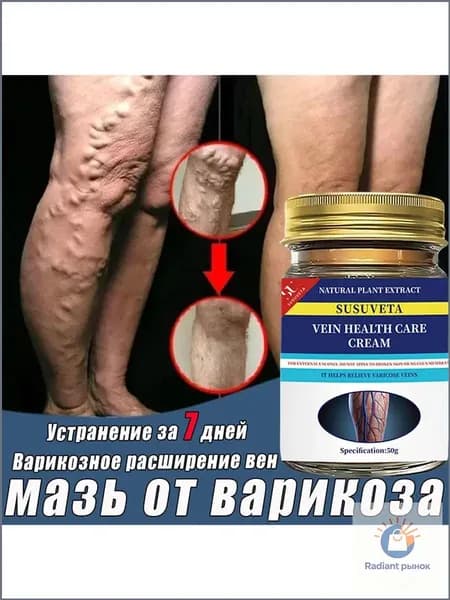 Крем от варикоза, для сосудов, отеков и тяжести в ногах, сосудистых звездочек, Эффективен при лечении варикозного расширения вен, 50г