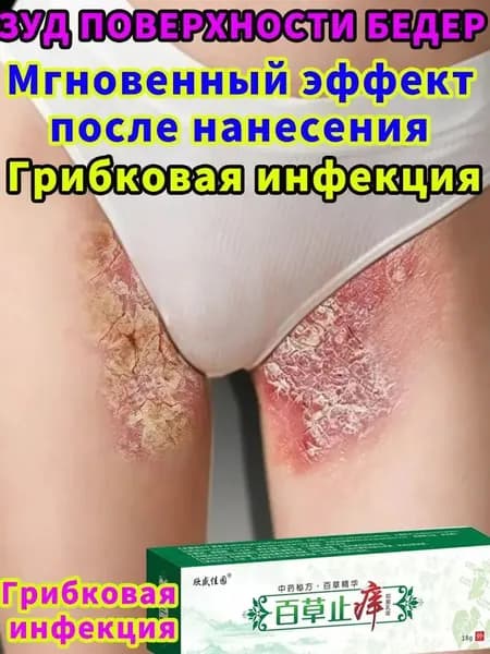 Мазь от Экзема псориаза на внутренней поверхности бедра, быстрое снятие воспаления и успокоение кожи для профилактики грибковых инфекций, 18