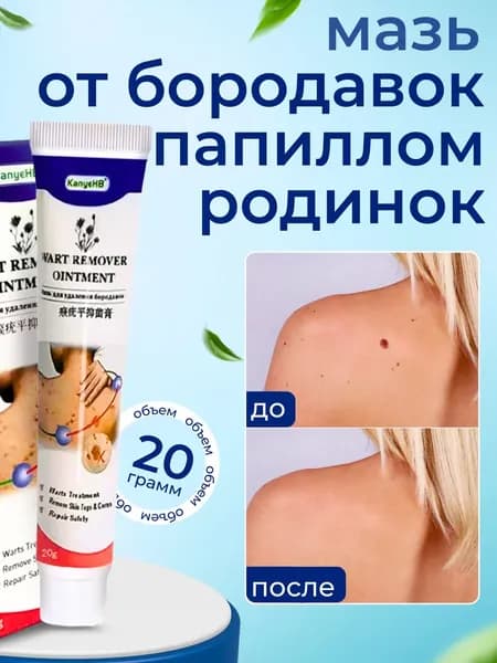 Мазь для удаления бородавок, папиллом и родинок.
