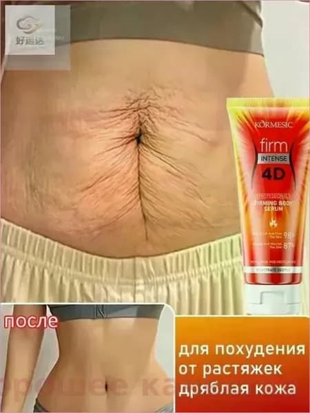 Эксклюзивный антицеллюлитный крем для моделирования тела, коррекции растяжек и упругости кожи