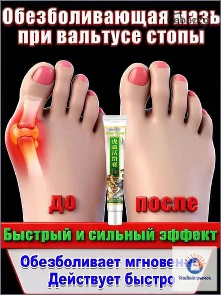 Гель от косточки на ноге, снимает боль и воспаление, выравнивает палец, для дневного и ночного использования. 20 г.