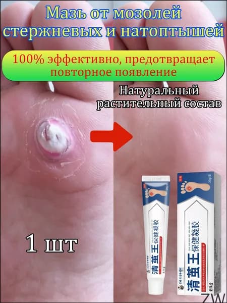 Mазь от мозолей стержневых и натоптышей ,Крем от сухих мозолей, шипицы, бородавок, натоптышей,20 г 1 шт.
