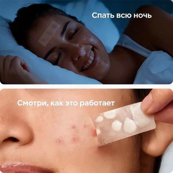 Большие гидроколлоидные наклейки от прыщей можно вырезать, крупногабаритные наклейки от прыщей для лица, тела, лба и спины, 5 шт.