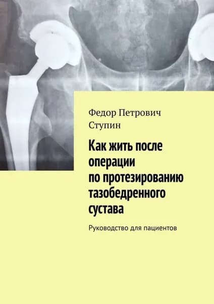 Как жить после операции по протезированию тазобедренного сустава. Руководство для пациентов | Федор Петрович Ступин | Электронная книга