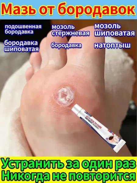 Лечение шипицы на стопе и подошвенной бородавки - крем от сухих мозолей