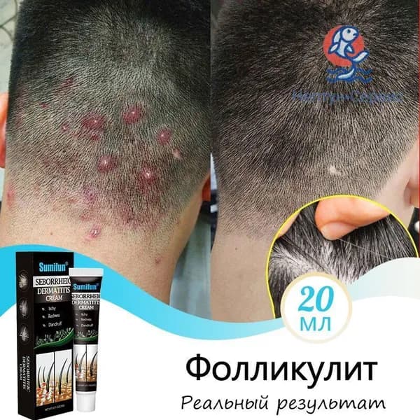 Средство для лечения кожи головы и волос