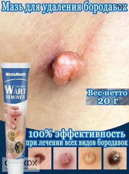 крем от бородавок и папиллом, средство для удаления сухих мозолей и натоптышей, уход за кожей рук и ног, 20 г
