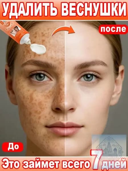 Отбеливающий и осветляющий крем. Используется для удаления веснушек, пигментных пятен и мелазмы; выравнивания тона кожи; устранения трудноудаляемых темных пятен и пигментации.60 г