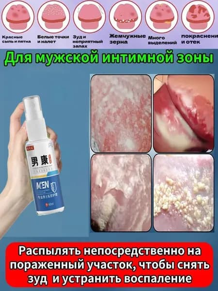 антибактериальный спрей от мужских инфекций, используемый для лечения зуда и воспалений в интимных частях тела, удаления грибков и неприятных запахов с половых органов.